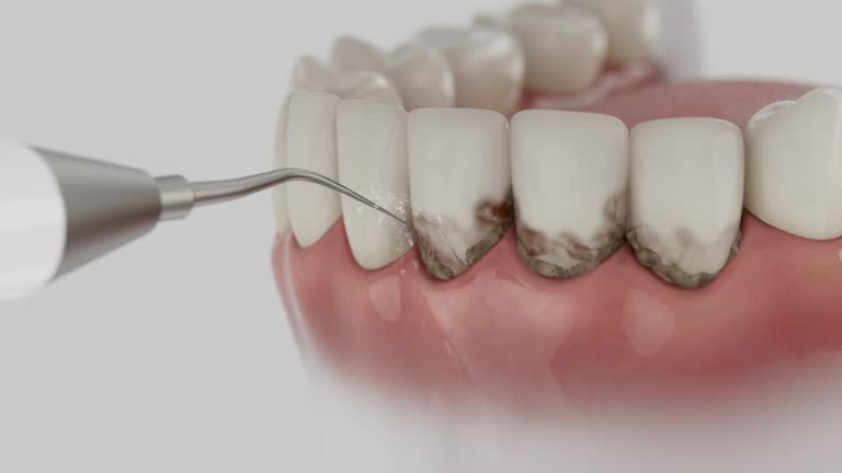 Reliable Dental contractor in Dunkirk, IN by Dentist Open Now